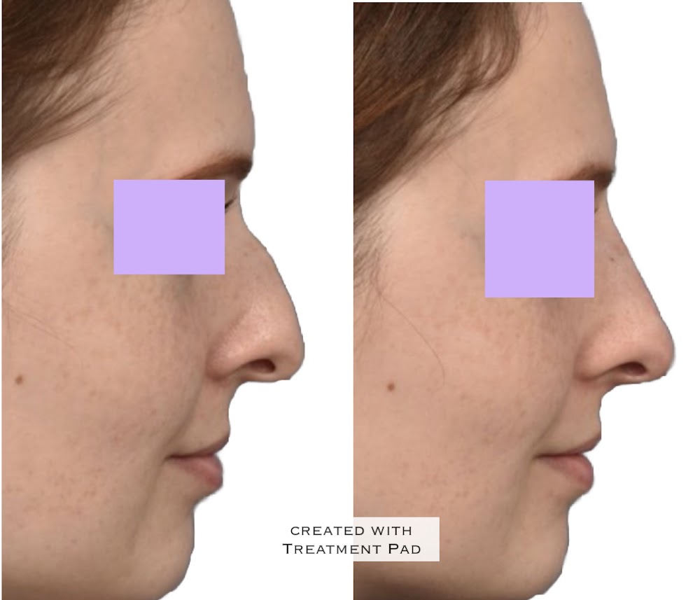 All About Medical Esthetics