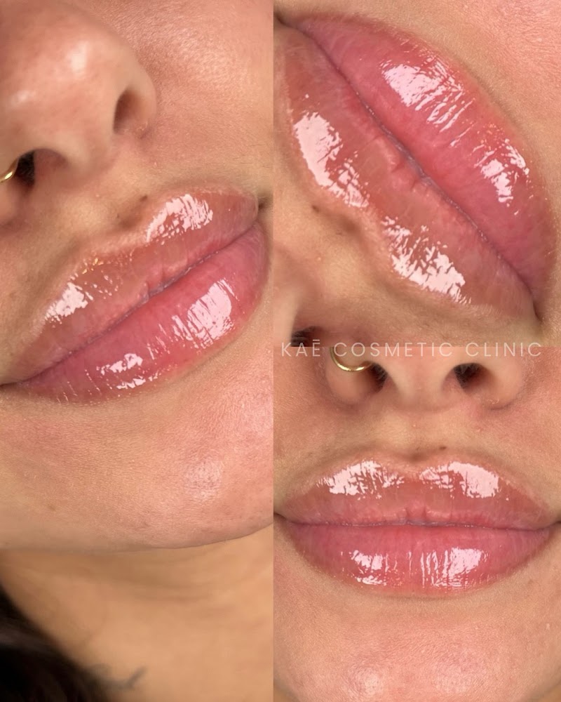 Kaē Cosmetic Clinic